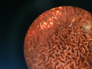 Fruting body under a microscope
